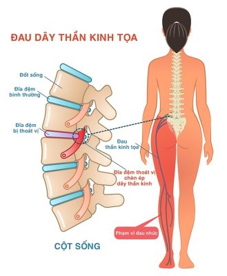 dau than kinh toan theo y hoc co truyen